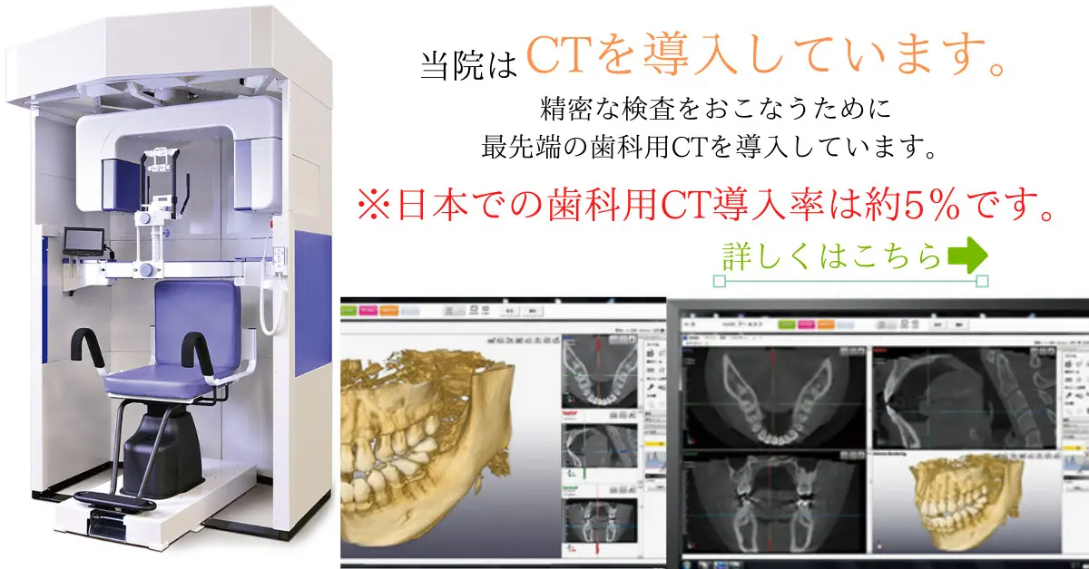 歯科用CT導入と撮影設備の案内