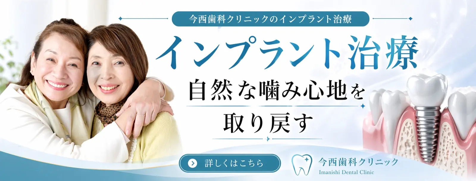 インプラント治療の案内